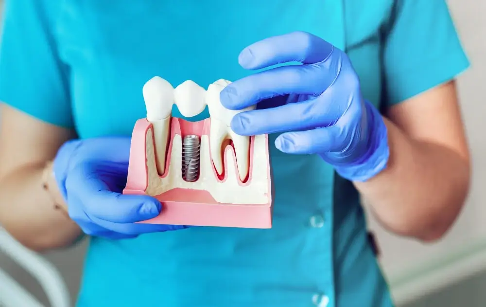ایمپلنت فوری و یک روزه دندان چیست؟