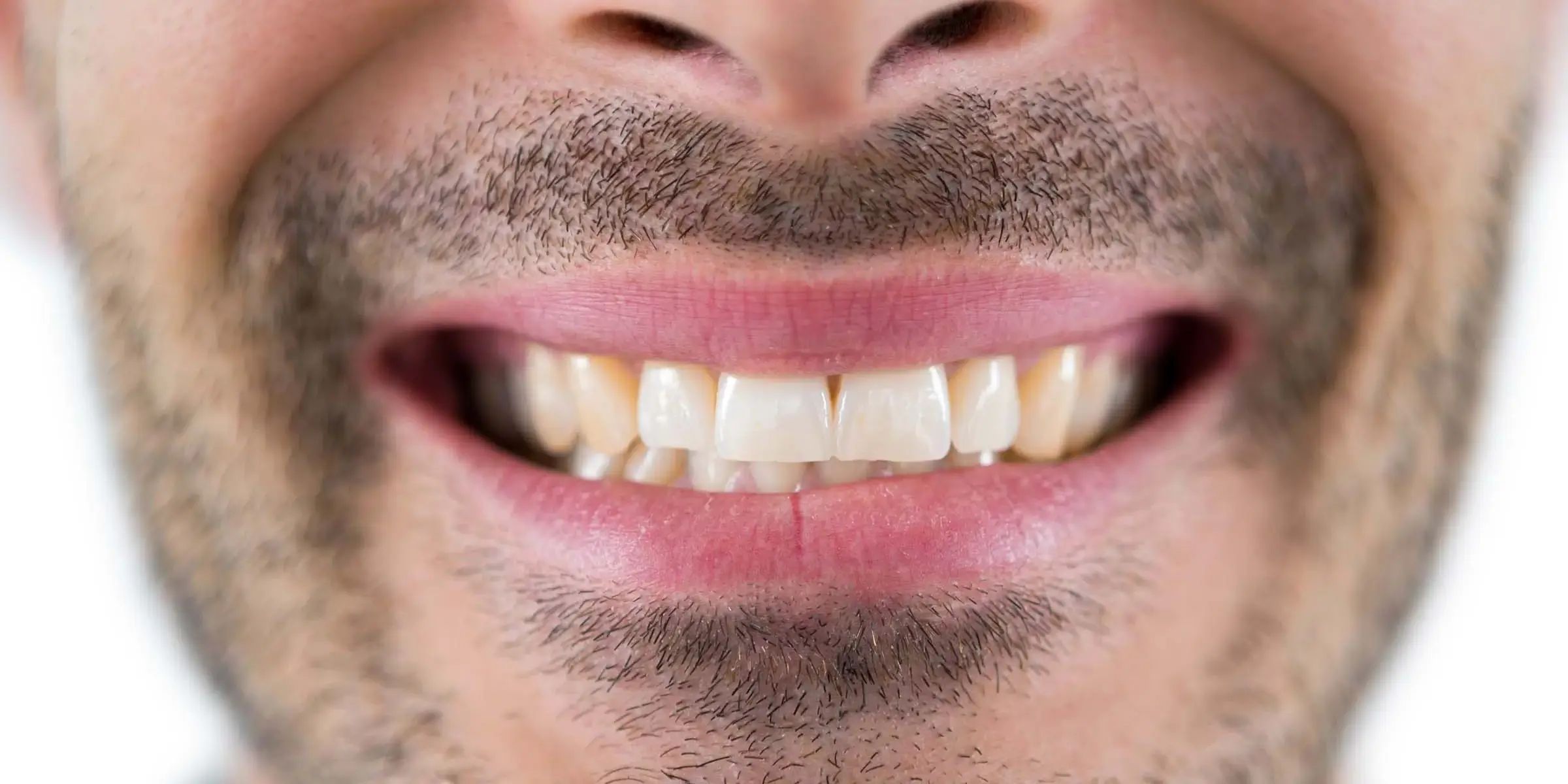 man-showing-his-teeth3-YUFNXWG